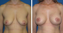 Before & After Photos